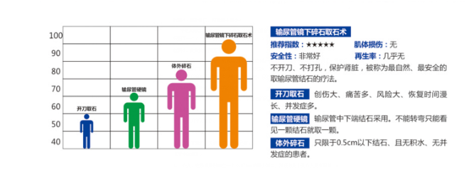 输尿管镜下无创取石术:无创、安全、快速解决梗阻/积水