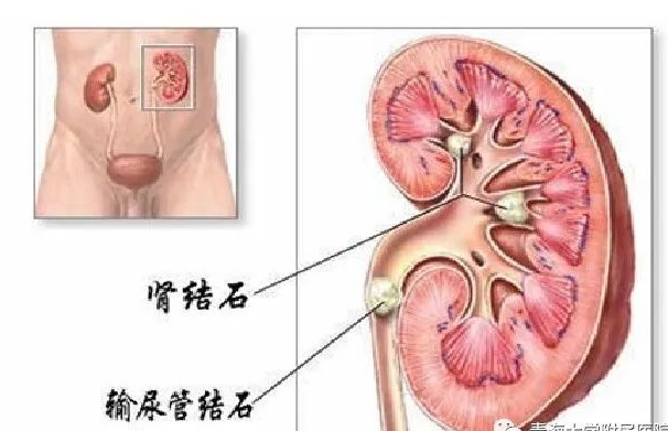 1693527743877182.png Snipaste_2023-08-16_16-18-14.png