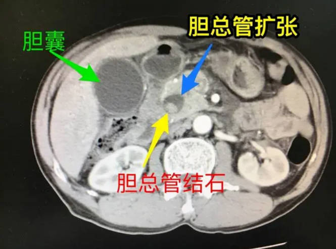 1700451494894864.jpg 2.jpg